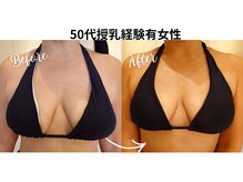 サロンハナ(Salon HANA)の雰囲気（「もう諦めていました」50代授乳経験有女性も美乳に甦りました）