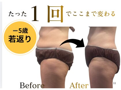 モミン(MOMI.N)の写真