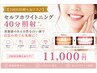 【2回目以降もおトク♪】セルフホワイトニング40分照射￥11,000