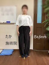 たか施術院/産後の骨盤 関節の痛み 30代初回