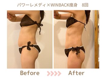 リトリト(Retreat)/8回ビフォアフター