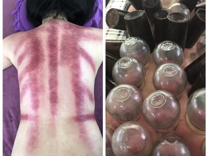 東洋経絡リラクゼーションの写真