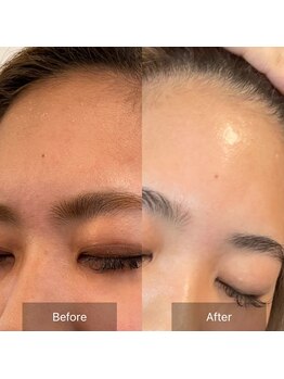 サロン ルイス アディクト(salon Lewis Addict)/ハーブピーリング