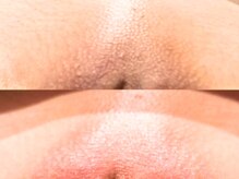 ドアディ(Doordie)/ローマピンク