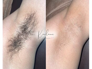 カイラニ サロン(Kai lanl salon)/男性　ワキ　
