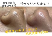 カンパニュラ(campanula)