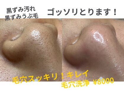 カンパニュラ(campanula)の写真