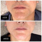 マリーローラン メンズルイズ(Marryrolan MensRuise)