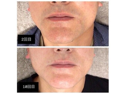 マリーローラン メンズルイズ(Marryrolan MensRuise)の写真