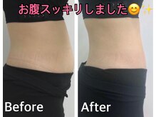 セラビシャン/before→after【お腹】