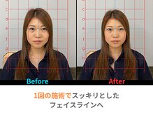 グローリー 甲府(GLORY)/1回目の変化