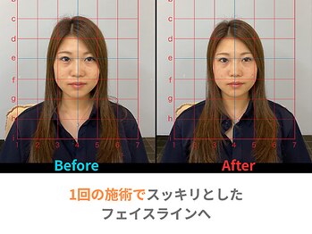 グローリー 甲府(GLORY)/1回目の変化