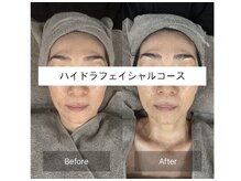 美容整体 ココ(COCO)/