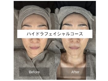 美容整体 ココ(COCO)/