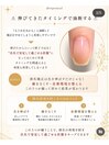 深爪再発を防ぐ3つのポイント