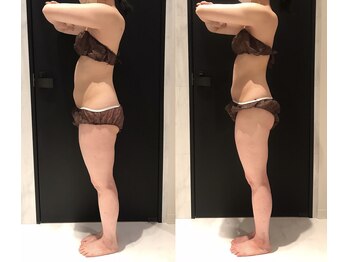 リボディ 表参道(An re Body)/before→after