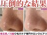 【人気NO1】 圧倒的な結果ヘ!毛穴のお悩み全て改善/黒ずみ 開き 角栓¥12,500