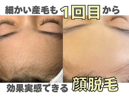 アール(ar.)の写真