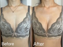 ベルフェム(Bellefemme)