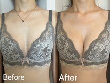 ベルフェム(Bellefemme)