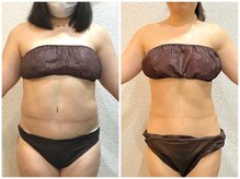 美容整体 ウェリナ 蟹江院/小顔矯正/骨盤矯正/美脚サロン