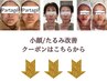 【小顔特化/小顔矯正/たるみ/引き締め/リフトアップ】↓↓↓
