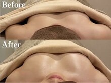 ジョリー(Jolie)/