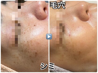 スハダボーテ(Suhada-beaute)の写真