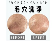 美容整体 ココ(COCO)/