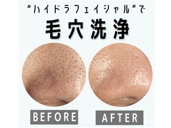 美容整体 ココ(COCO)/