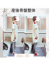 リボーン(Be.Reborn)/施術後