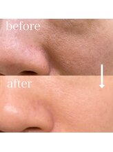 シェノン 赤坂大濠店/