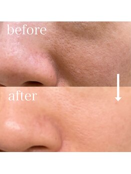 シェノン 赤坂大濠店/