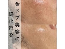 西新宿アンドマインドプラス(&mind+)の雰囲気（当店オリジナルメソッドはリバウンドしない本質的な肌改善。）
