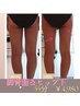 浮腫改善【美尻美脚コース】 キャビ+ラジオ波+痩身マッサージ55分￥5,500→