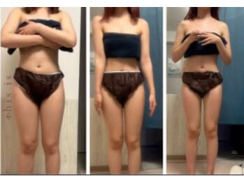 オーシャンブルーム 目黒(OceanBloom)/３ヶ月週1ペースブライダル痩身