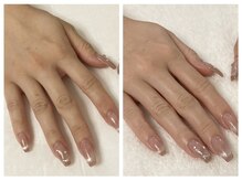 キレイテ 福岡天神店/モデリングパックで明るい手肌に