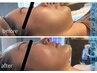 《初回体験》切らないフェイスリフト小顔&頭蓋骨調整+筋膜リリース