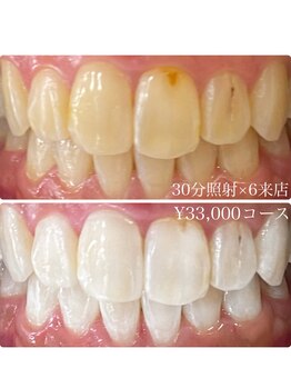 ホワイトニングルーム 川崎店(WhiteningRoom)/ホワイトニング/川崎