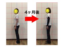 まもる整体サロン 新山口店/20代　産後の体型