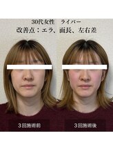 ザ リフト カドモリ 鹿児島 霧島(The Lift KADOMORI)/30代女性/面長、左右差