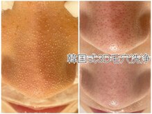 モーヴ(MAUVE)/韓国式３D毛穴洗浄