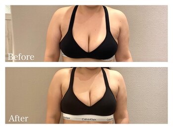 ククナ(KUKUNA)/*バストアップマッサージ*