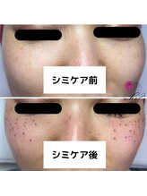 フー(Who?)/結果は出すもの♪