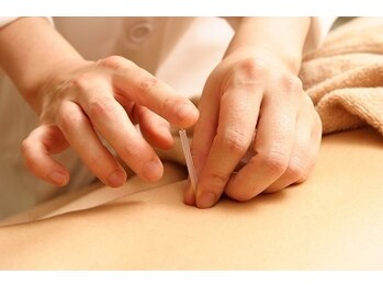 天命堂しらとり台整体院の写真/「どこへ行っても変わらない」と諦める前に！長引く慢性的な痛みを根本改善◎深層へ届く鍼灸￥6,680～