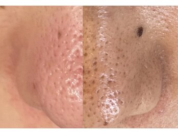 ジェリー(JERRY)/酸化