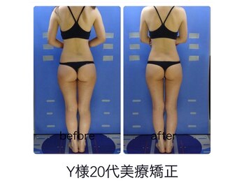 エステージ(estage)/