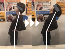 ミライズ整体院 三宮駅前院/事例【30代女性・腰痛】