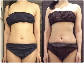 美容整体ウェリナ 名駅院/小顔矯正/骨盤矯正/美脚サロン