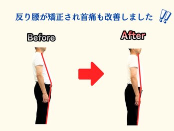 アオ(ao)/整体 Before→After